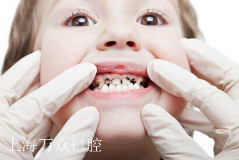 小孩子牙齿腐蚀原因是什么?女儿牙齿很疼,晚上
