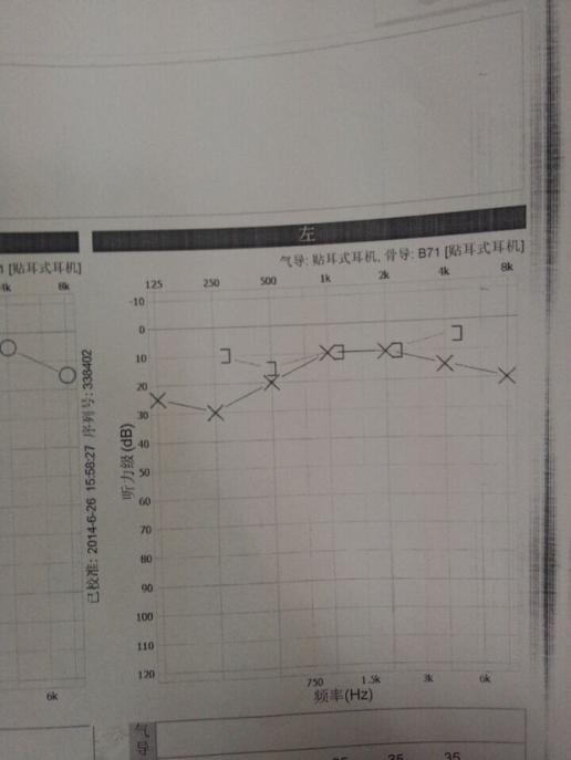 这张图是我左耳的纯音