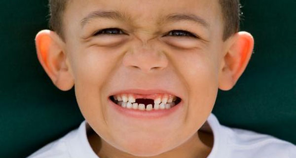 儿童换牙的七大注意事项