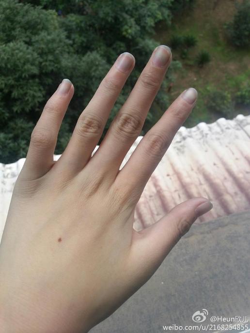 亲爱的我的指甲变色怎么回事?