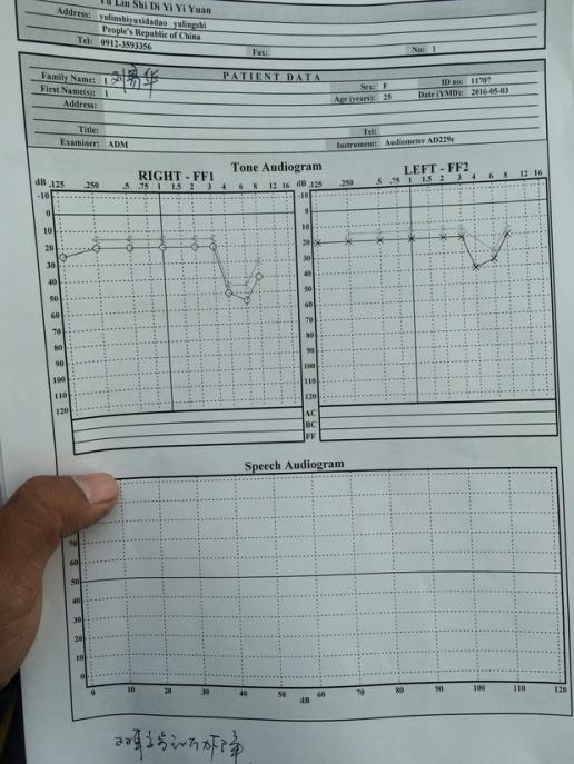 请问这个份听力图怎么看 从医院做了检查了?