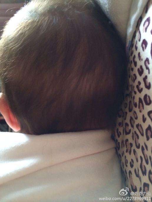 宝宝三个月头发后面这一圈头发少是缺钙还是在枕头上磨的啊?
