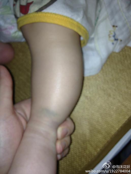 我宝宝四个月小腿有点弯 会不会影响以后走路啊 可以做什么措施腿直点