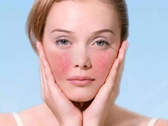 为什么护肤品擦脸上有点刺痛，可能是这些原因