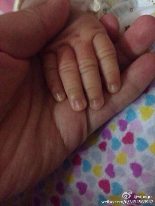 麻烦看一下,宝宝指甲根部有点发黑,请问是什么原因造成的呢?