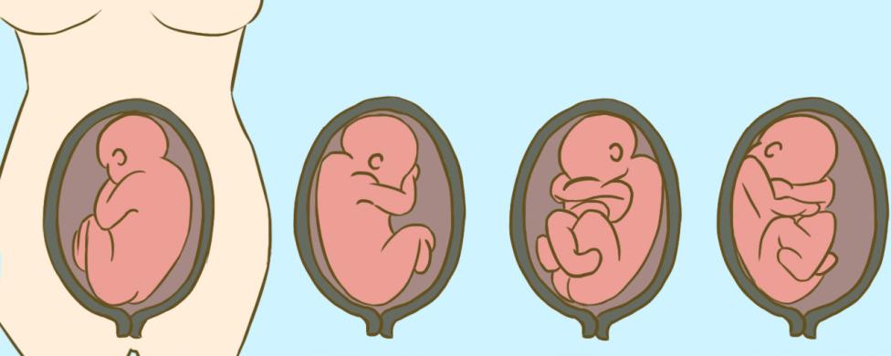 孕晚期rop胎位图图片