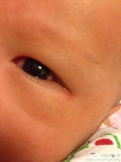 您好,我们宝宝现在出生40天,今天早上发现一个眼睛眼角发红,眼里总有