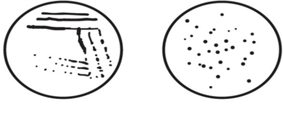 稀释涂布平板法微生物图片