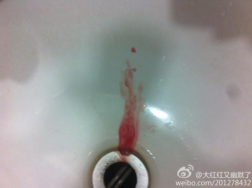 吐血厕所图片