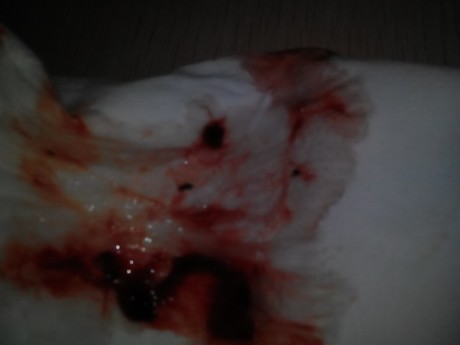流了很多血鼻血的图片图片