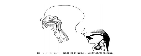 柴油机水箱气大怎么解决