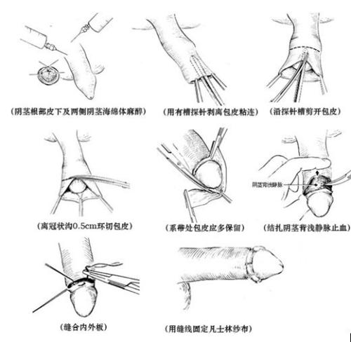 割皮包正常的图片大全图片