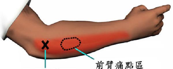 普拉多更换缸垫后哒哒响